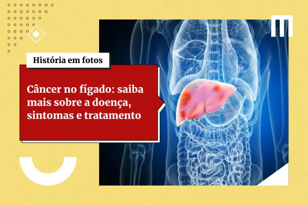 Câncer de fígado: veja sintomas da doença que não devem ser ignorados