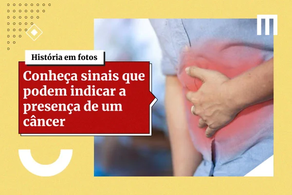 Pesquisadores encontram proteína ligada ao avanço do câncer de ovário