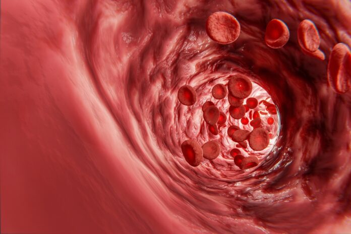 Cardiologista-explica-o-que-acontece-no-corpo-quando-arterias-entopem.jpg