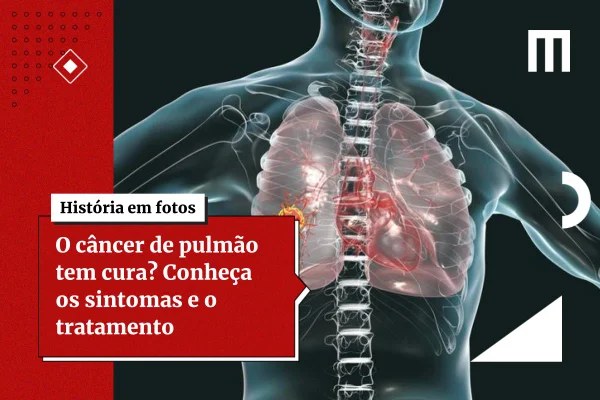 Como funciona 1ª vacina do mundo para prevenção do câncer de pulmão