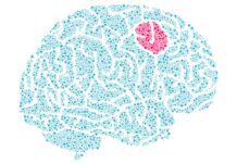 Estudo revela como tumores cerebrais reagem à falta de nutrientes