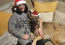 Mulher perde pés e mãos após sepse causada por lambida de cachorro Ícone de sino para notificações