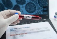 Brasil Registra 140 Casos Confirmados De Mpox Brasil Registra 140 Casos Confirmados De Mpox