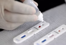SUS Passa A Oferecer Teste Rápido Para Diagnóstico Da Dengue SUS Passa A Oferecer Teste Rápido Para Diagnóstico Da Dengue