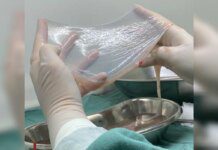 SUS amplia uso de tecido amniótico para tratar pacientes com diabetes Ícone de sino para notificações