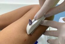 Saúde Amplia Capacitação Para Implante Contraceptivo No SUS Saúde Amplia Capacitação Para Implante Contraceptivo No SUS