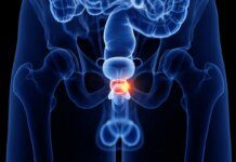Urologista lista quais são os primeiros sintomas de próstata aumentada Ícone de sino para notificações
