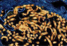 Surto: CDC da África confirma 395 casos de ebola e 106 mortes Ícone de sino para notificações