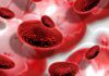 Cansaço constante pode ser sinal de anemia por deficiência de ferro Cansaço constante pode ser sinal de anemia por deficiência de ferro
