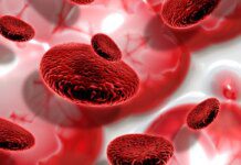 Cansaço constante pode ser sinal de anemia por deficiência de ferro Cansaço constante pode ser sinal de anemia por deficiência de ferro