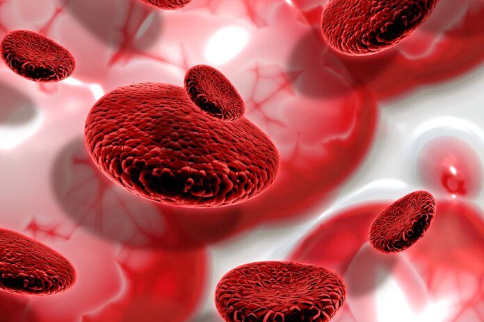Cansaço constante pode ser sinal de anemia por deficiência de Cansaço constante pode ser sinal de anemia por deficiência de ferro