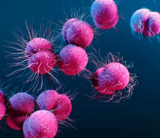 Casos de gonorreia resistente a antibiótico aumentam na Europa Casos de gonorreia resistente a antibiótico aumentam na Europa
