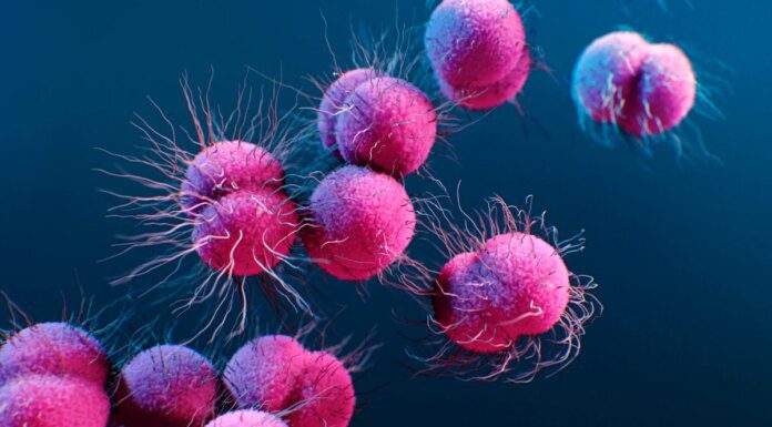 Casos de gonorreia resistente a antibiótico aumentam na Europa Casos de gonorreia resistente a antibiótico aumentam na Europa