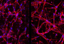 Cientistas criam células da retina em laboratório para tratar cegueira Cientistas criam células da retina em laboratório para tratar cegueira