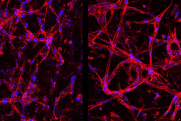 Cientistas criam células da retina em laboratório para tratar cegueira
