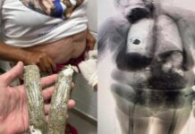 Idosa é Presa Após Esconder Drogas Na Roupa Para Entrar Em Presídio Idosa é Presa Após Esconder Drogas Na Roupa Para Entrar Em Presídio