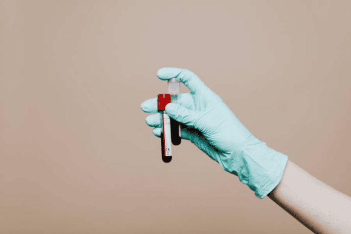 Campanha Oferece Exames De DNA Gratuitos Em Duas Cidades Da Bahia Nesta Sexta