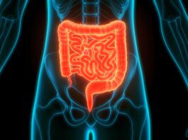 SUS passa a oferecer teste de fezes para rastrear câncer de intestino SUS passa a oferecer teste de fezes para rastrear câncer de intestino