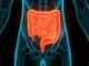 SUS passa a oferecer teste de fezes para rastrear câncer de intestino SUS passa a oferecer teste de fezes para rastrear câncer de intestino