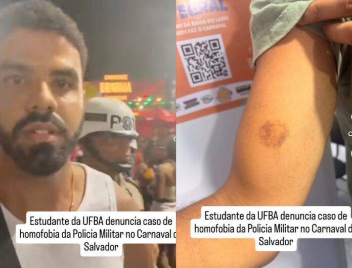 Sete PMs São Denunciados Por Agressões Contra Foliões No Carnaval De Salvador